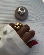 انگشتر دامله